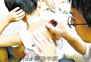 灸法的種類  你知道多少？